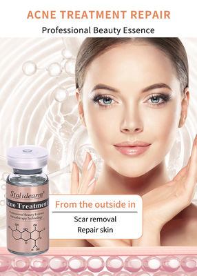 Best Facial Acne Treatment Product Remove Acne Smooth Skin And Shrink Pores Serum  Lightening Whitening Essence