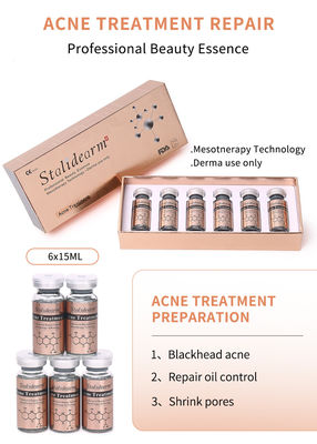 Best Facial Acne Treatment Product Remove Acne Smooth Skin And Shrink Pores Serum  Lightening Whitening Essence