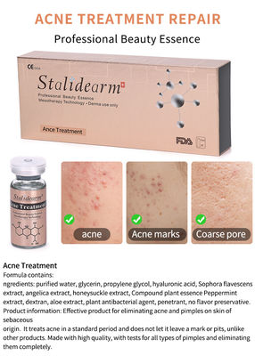 Best Facial Acne Treatment Product Remove Acne Smooth Skin And Shrink Pores Serum  Lightening Whitening Essence