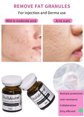 Skin Booster 5ml Skin Repairing Mesotherapy Serum Injection For Ance Treatment