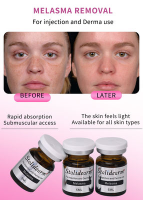 Exosome Injection Melasma Mesotherapy Solution Dermal Fillers Injectable Serum