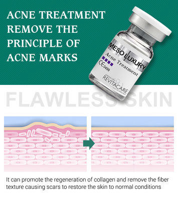 MESO LUXURY Skin Booster Pure Plant Pimple Clear Serum Whitening Mesotherapy Solution For Acne Treatment