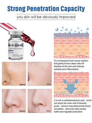 Mesotherapy Solution Exosome Dermal Pen Skin Whitening Serum Set MESO Luxury Formulated In France