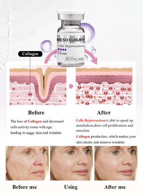 Mesotherapy Solution Meso luxury Cells Rejuvenating Power Serum Anti Aging Microneedling For Skin Whitening