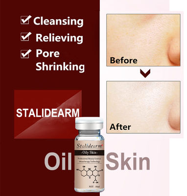 Microneedle Serum Mesotherapy Ance Treatment Anti Acne Customized Label Dermal Pen Face Essence For Oily Skin