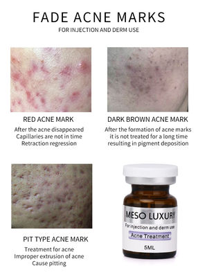 Luxury Youth Serum Injection Mesotherapy Red Spots Skin Acne Injection Treatment
