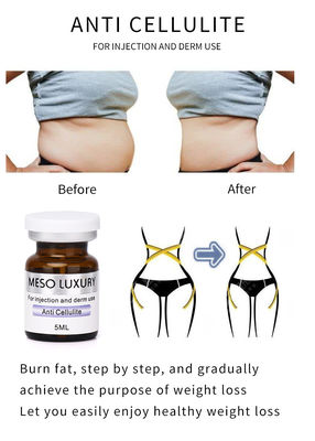 Anti Cellulite Mesotherapy Slimming Essence Losing Weight Belly Fat Burning Exosomes Serum