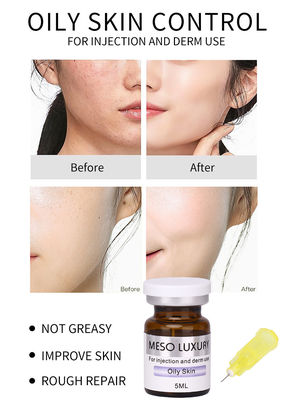 Skin Booster Exosomes Treatment MESO Serum Mesotherapy Solution For Oily Skin
