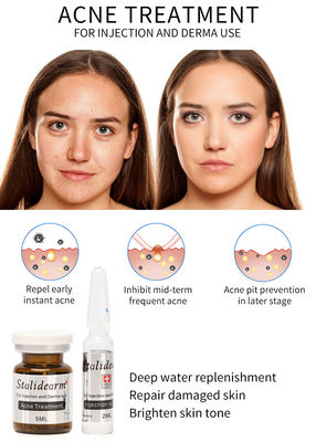 Exosome Skin Booster France Original Stalidearm Acne Treatment Injection Serum Mesotherapy Solution