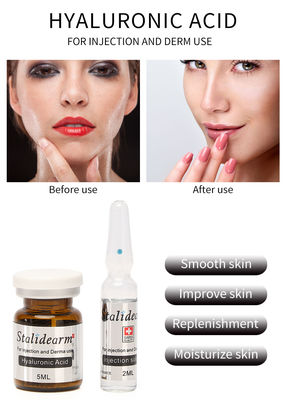 Exosome Injectable Serum Hyaluronic Acid France Original Stalidearm High Quality Anti Aging Mesotherapy Solution