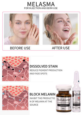 Melasma Injection Mesotherapy Solution Exosome Skin Booster Botox Dermal Filler