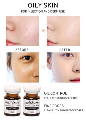 Injection Serum For Oily Skin 5ml/Bottle Safe Good Effect Essence Set Original Stalidearm Brand
