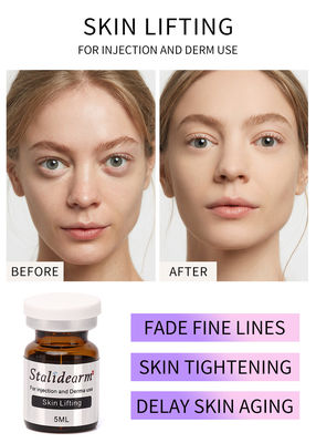 Exosomes Skin Booster Stalideram Anti Aging Skin Lifting Injectable Mesotherapy Solution